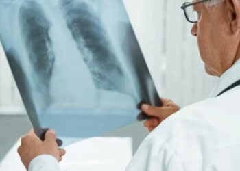 RD detecta 4,000 casos de tuberculosis al año; nueva estrategia busca erradicarla