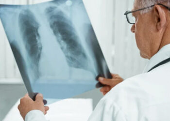 Aumentan un 10 % los casos de tuberculosis infantil en Europa
