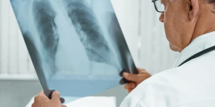 Aumentan un 10 % los casos de tuberculosis infantil en Europa