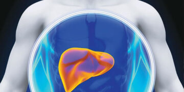 Más de 2,000 personas se curan de hepatitis C en Puerto Rico