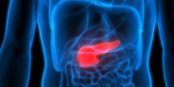 CNIO identifica genes que elevan riesgo de cáncer de páncreas