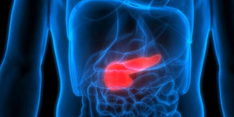 CNIO identifica genes que elevan riesgo de cáncer de páncreas