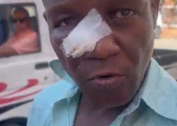 Profesor denuncia fractura nasal tras agresión estudiantil