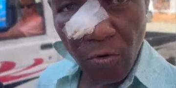 Profesor denuncia fractura nasal tras agresión estudiantil
