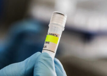 OMS pide seguir protocolos por casos de hantavirus