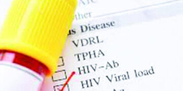 Más de 56 mil pacientes mantienen carga viral de VIH