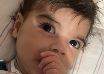 Salud Pública garantiza tratamiento para niños con AME